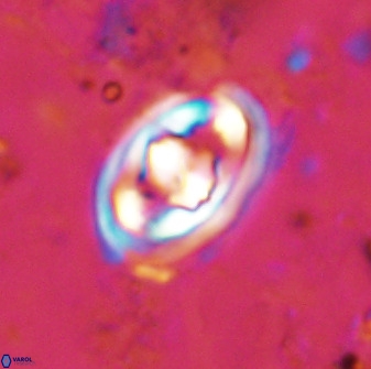 Gorkaea pomerolii 48003