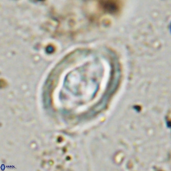 Gorkaea pomerolii 48005