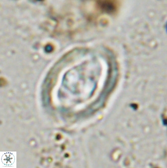 Gorkaea pomerolii 48005
