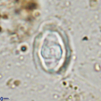 Gorkaea pomerolii 48006