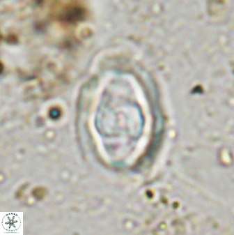 Gorkaea pomerolii 48006