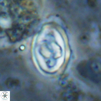 Gorkaea pomerolii 48007