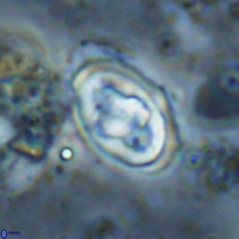Gorkaea pomerolii 48009