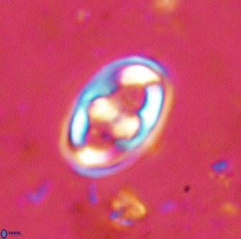 Gorkaea pomerolii 48492