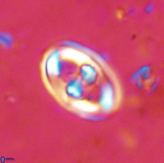Gorkaea pomerolii 48496