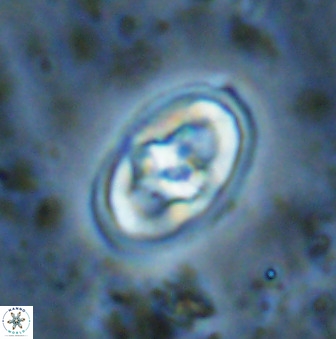 Gorkaea pomerolii 48501