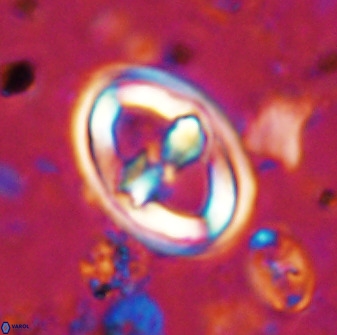 Gorkaea pomerolii 36767