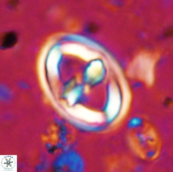 Gorkaea pomerolii 36767