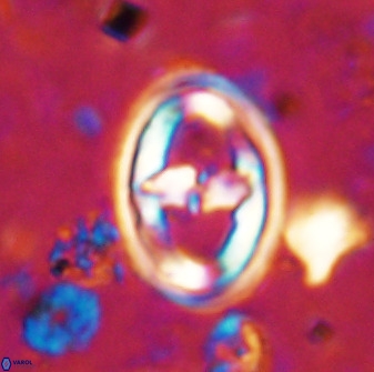 Gorkaea pomerolii 36768