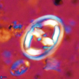 Gorkaea pomerolii 36771