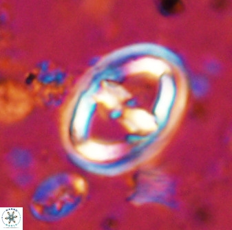 Gorkaea pomerolii 36771