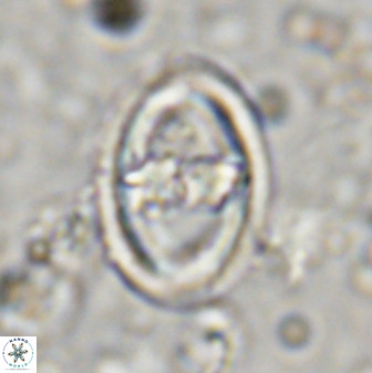 Gorkaea pomerolii 36772