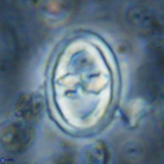 Gorkaea pomerolii 36773
