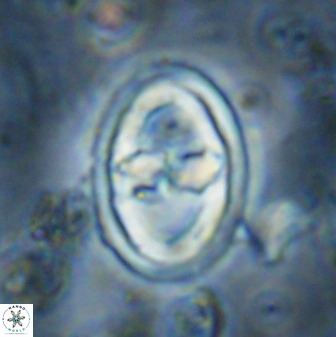 Gorkaea pomerolii 36773