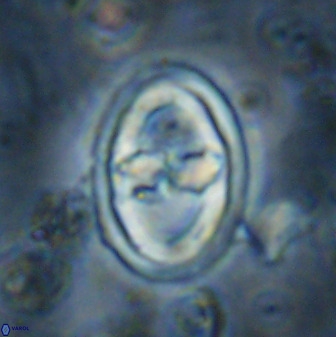 Gorkaea pomerolii 36774