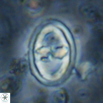 Gorkaea pomerolii 36774