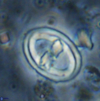 Gorkaea pomerolii 36775
