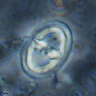 Gorkaea pomerolii 36776