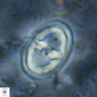 Gorkaea pomerolii 36776