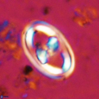 Gorkaea pomerolii 38983