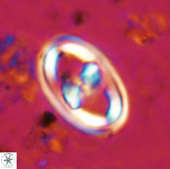 Gorkaea pomerolii 38983