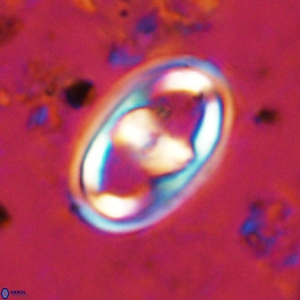 Gorkaea pomerolii 38985