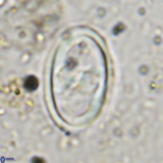 Gorkaea pomerolii 38986