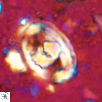 Gorkaea pomerolii VR 21554