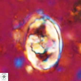 Gorkaea pomerolii VR 21555