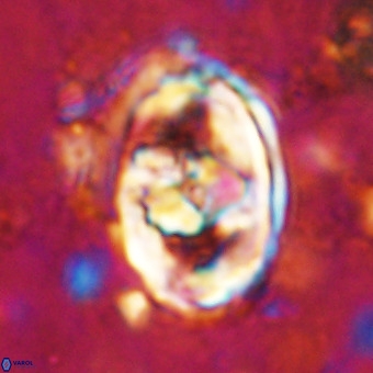 Gorkaea pomerolii VR 21558