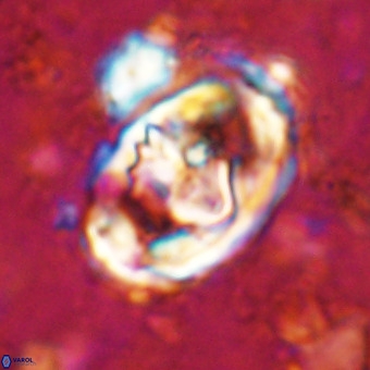 Gorkaea pomerolii VR 21559