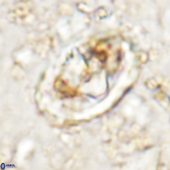 Gorkaea pomerolii VR 21564