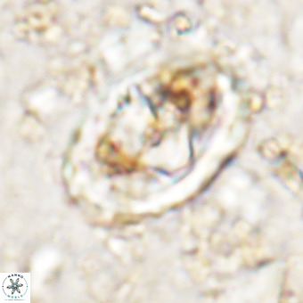Gorkaea pomerolii VR 21564