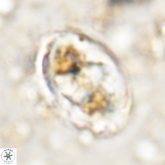 Gorkaea pomerolii VR 21567