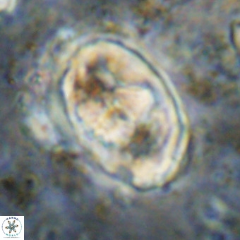 Gorkaea pomerolii VR 21568