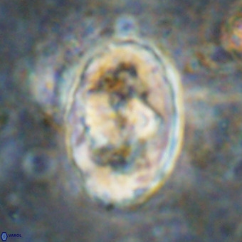 Gorkaea pomerolii VR 21569