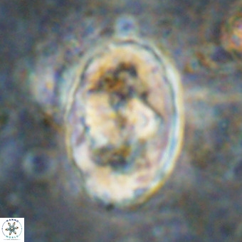 Gorkaea pomerolii VR 21569
