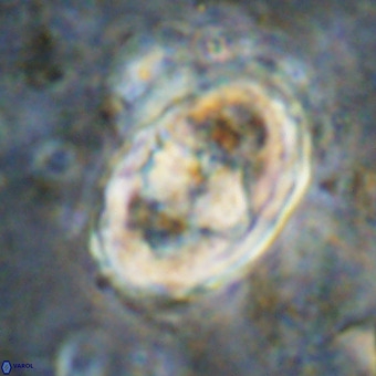 Gorkaea pomerolii VR 21570