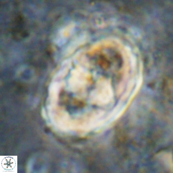 Gorkaea pomerolii VR 21570