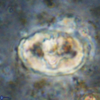 Gorkaea pomerolii VR 21571