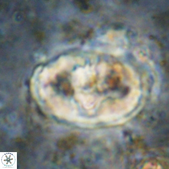 Gorkaea pomerolii VR 21571