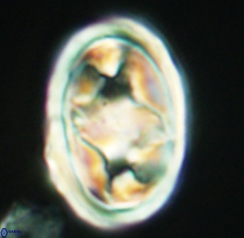 Gorkaea pseudanthophorus 2751
