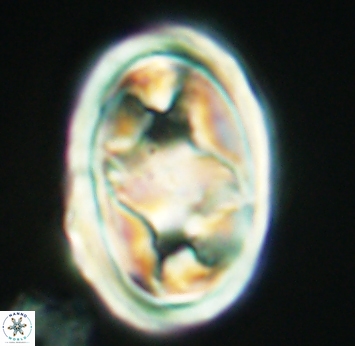 Gorkaea pseudanthophorus 2751