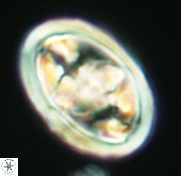 Gorkaea pseudanthophorus 2754