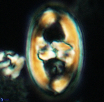 Gorkaea pseudanthophorus 3190