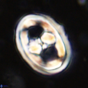Gorkaea pseudanthophorus 36867