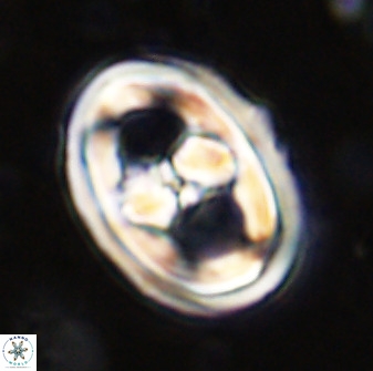 Gorkaea pseudanthophorus 36867