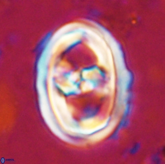 Gorkaea pseudanthophorus 36869