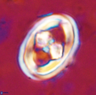 Gorkaea pseudanthophorus 36872