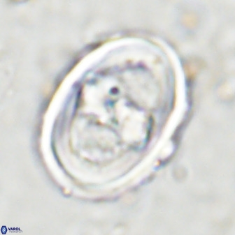 Gorkaea pseudanthophorus 36873